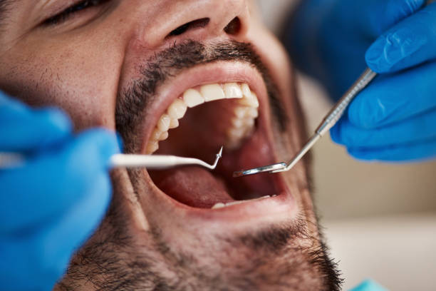 Best Emergency Root Canal Therapy in Red Oak, NC